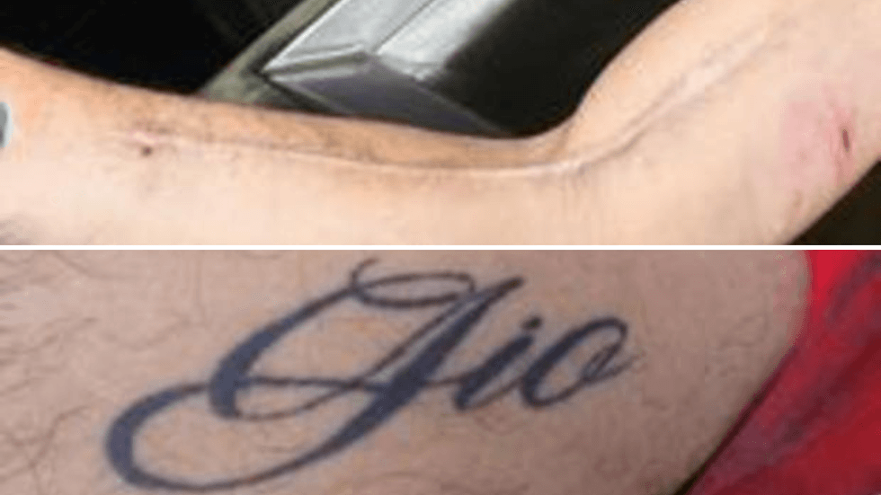Scars found on the victim (top), the tattoo detectives believe spells out "Gio" or "Gia" (bottom)