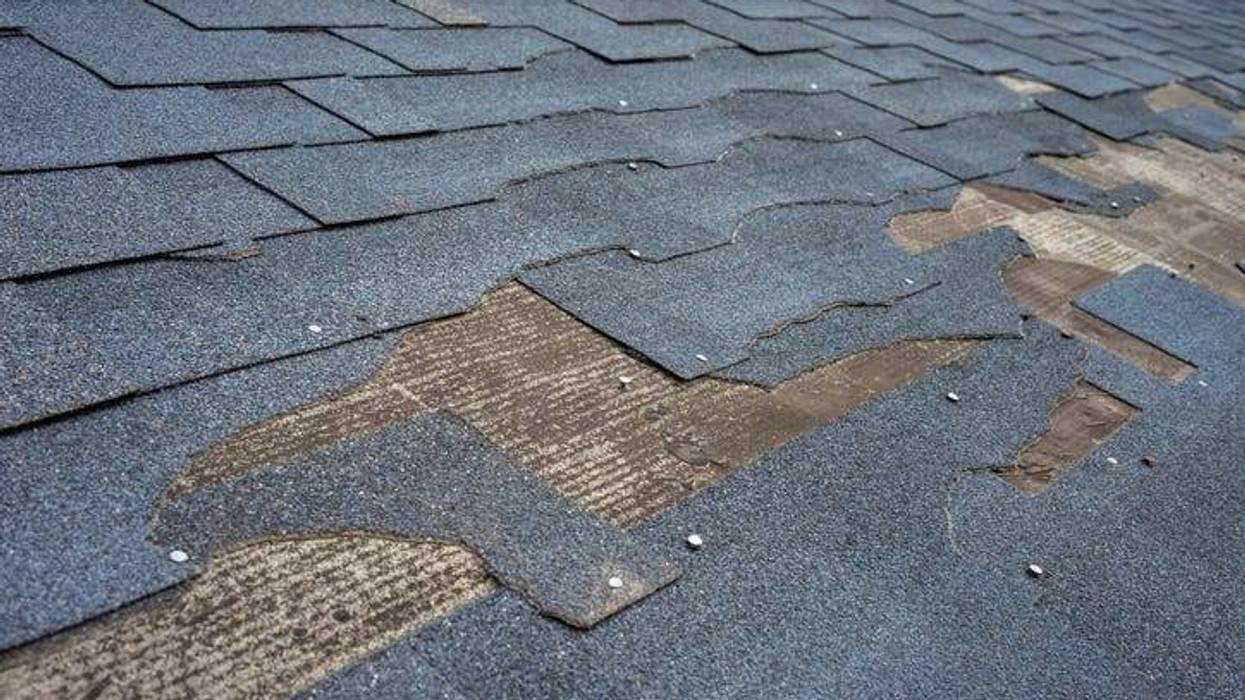 Shingles