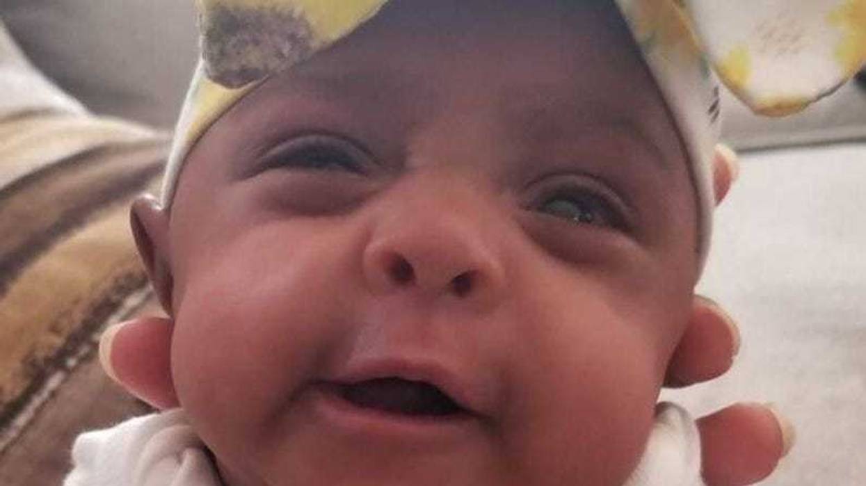 Smallest surviving baby