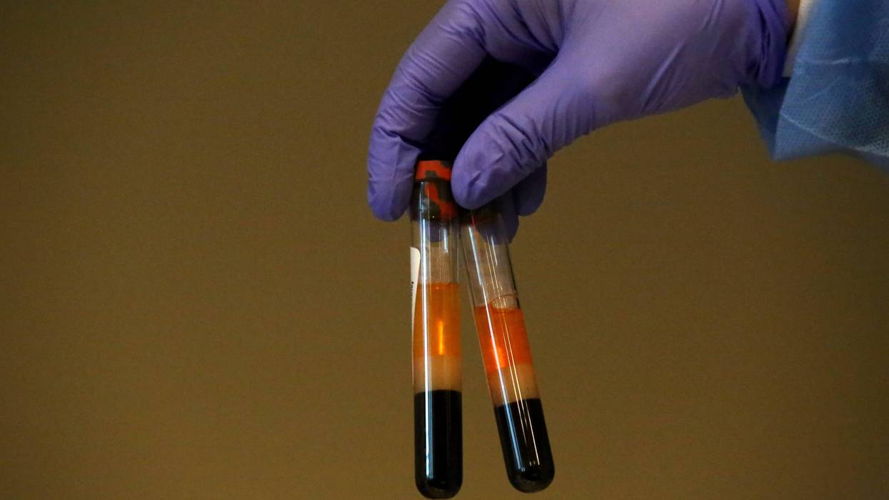 SPRING VALLEY, NY - APRIL 24: A phlebotomist shows to the camera specimens of people getting tested for coronavirus antibodies at the Refuah Health Center on April 24, 2020 in Spring Valley, New York.