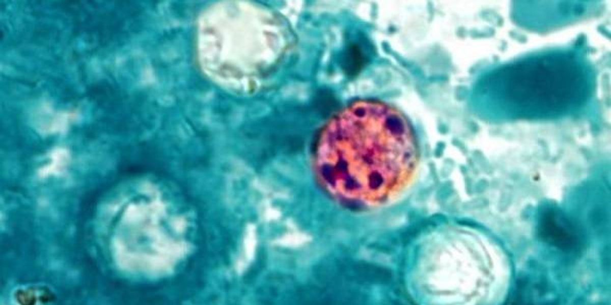 Allegheny Co. confirms nearly a dozen cyclosporiasis cases