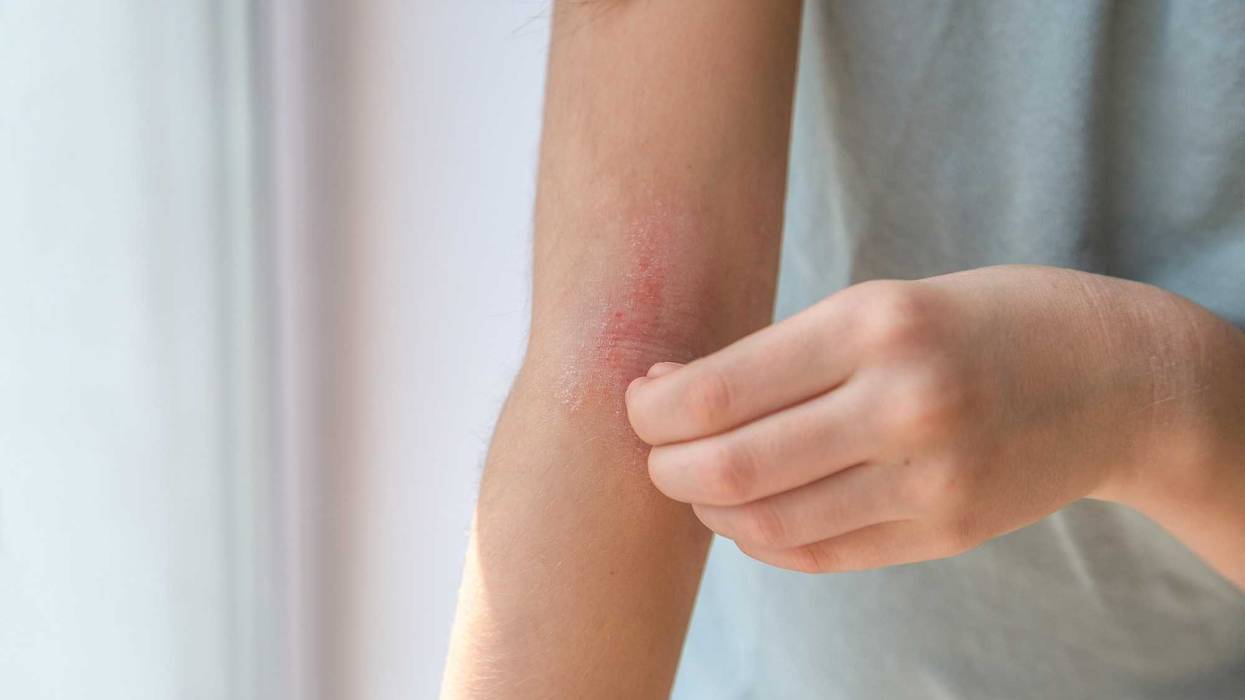 stock image itchy skin