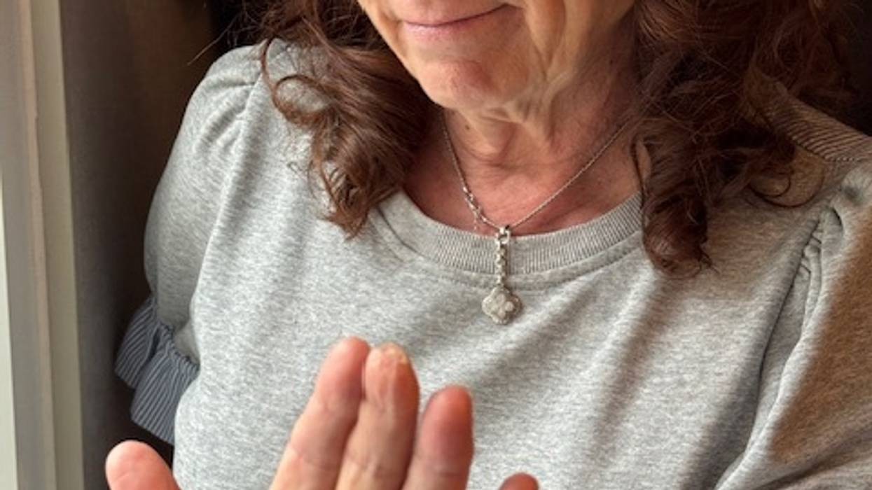 Sue's 4 Finger Print Situation