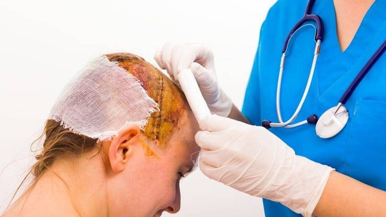 Surgeon with protective glove bandaging smiling victim's head after skull fraction.