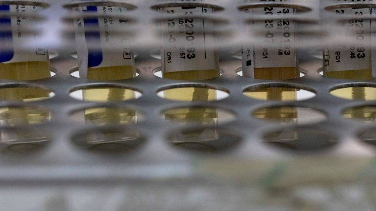 Suspected monkeypox samples stands on a table before being PCR tested at the microbiology laboratory of La Paz Hospital on June 06, 2022 in Madrid, Spain.