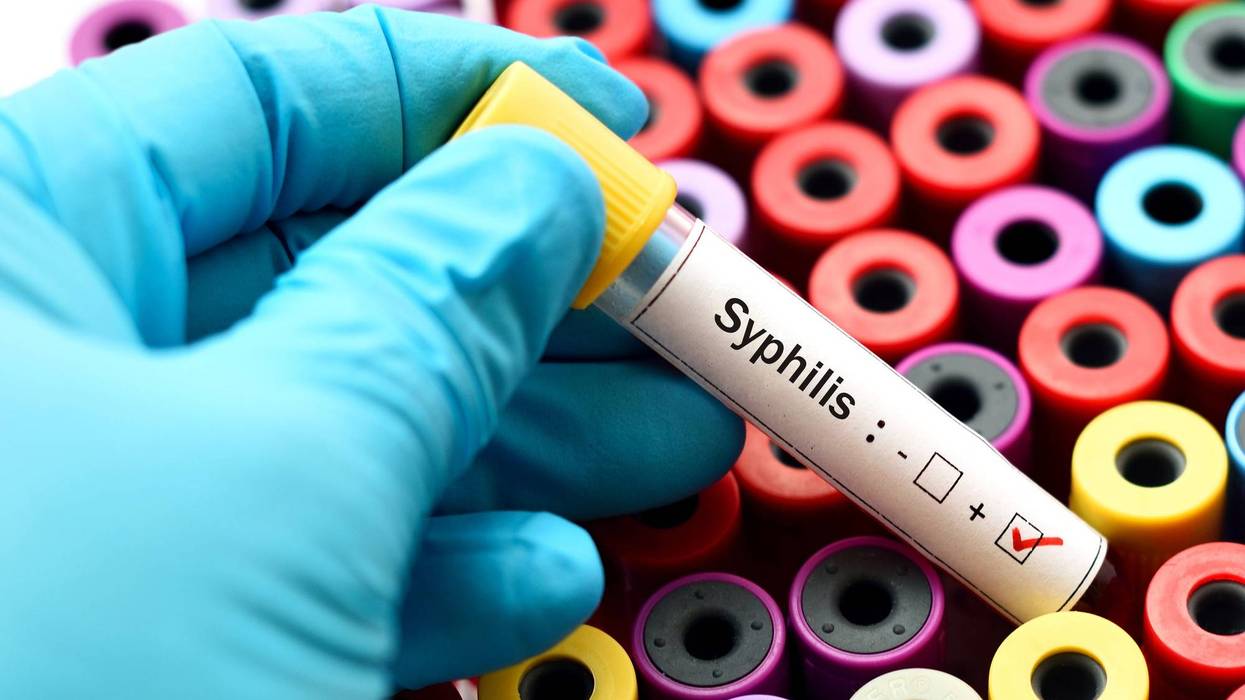 Syphilis test