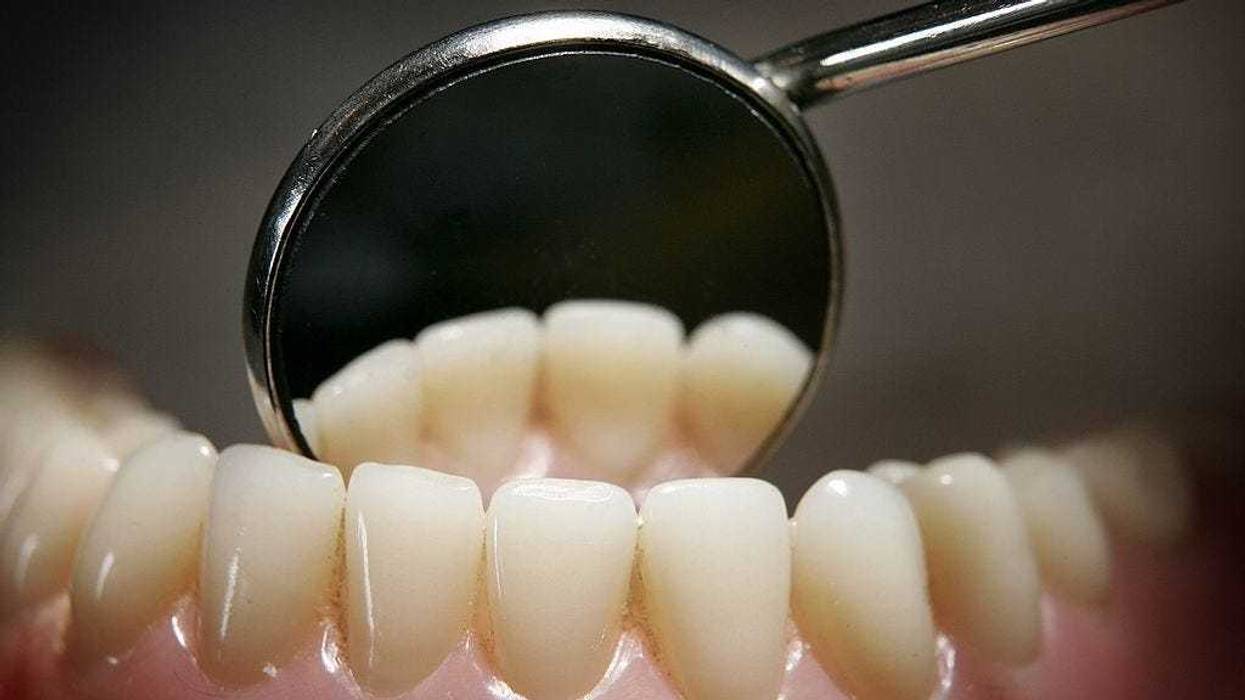 Teeth on a model denture set are reflected in a dental mirror on April 19, 2006 in Great Bookham, England.