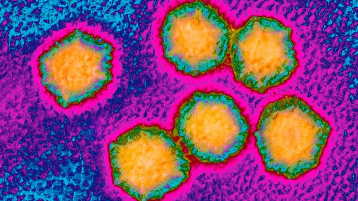 The Hepatitis A virus is seen under a microscope