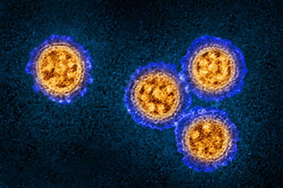 The influenza virus as seen from a transmission electron microscopy view