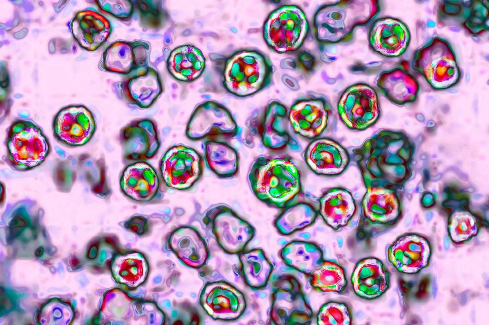 The measles virus, paramyxoviridae from the Morbillivirus family, transmission microscopy view.