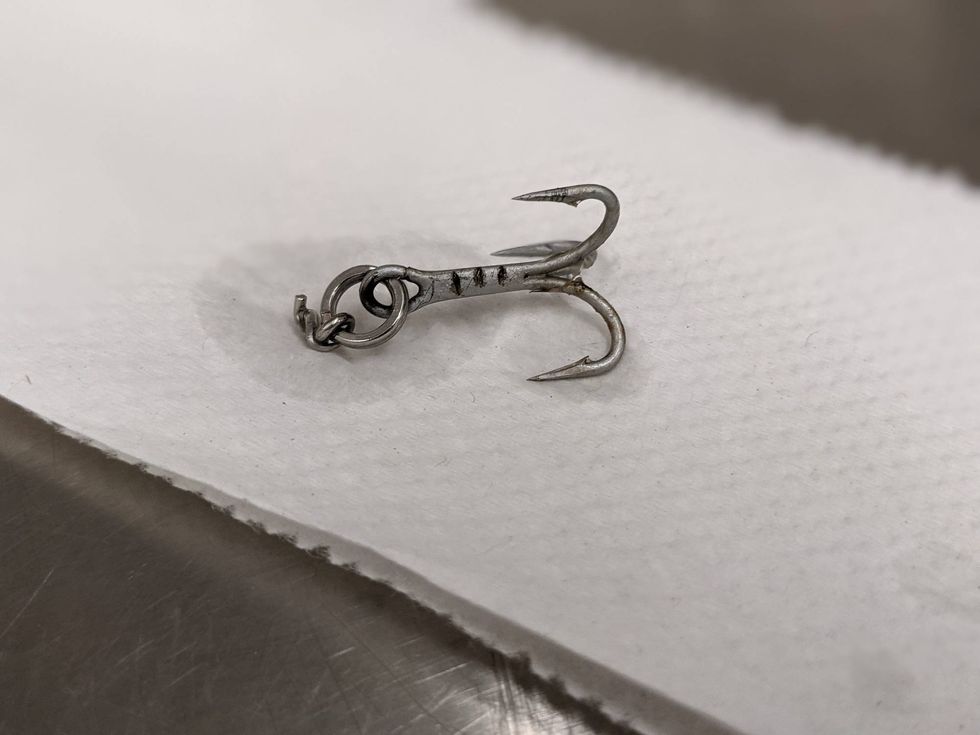 The one-inch fishing hook removed from "Merritt."