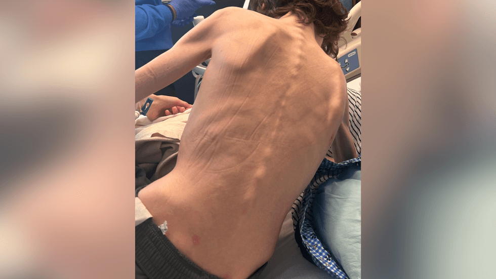 The parents of twin teenage boys are facing criminal charges after state troopers found one of the teens wandering his Lehigh Valley neighborhood naked and malnourished last week.
