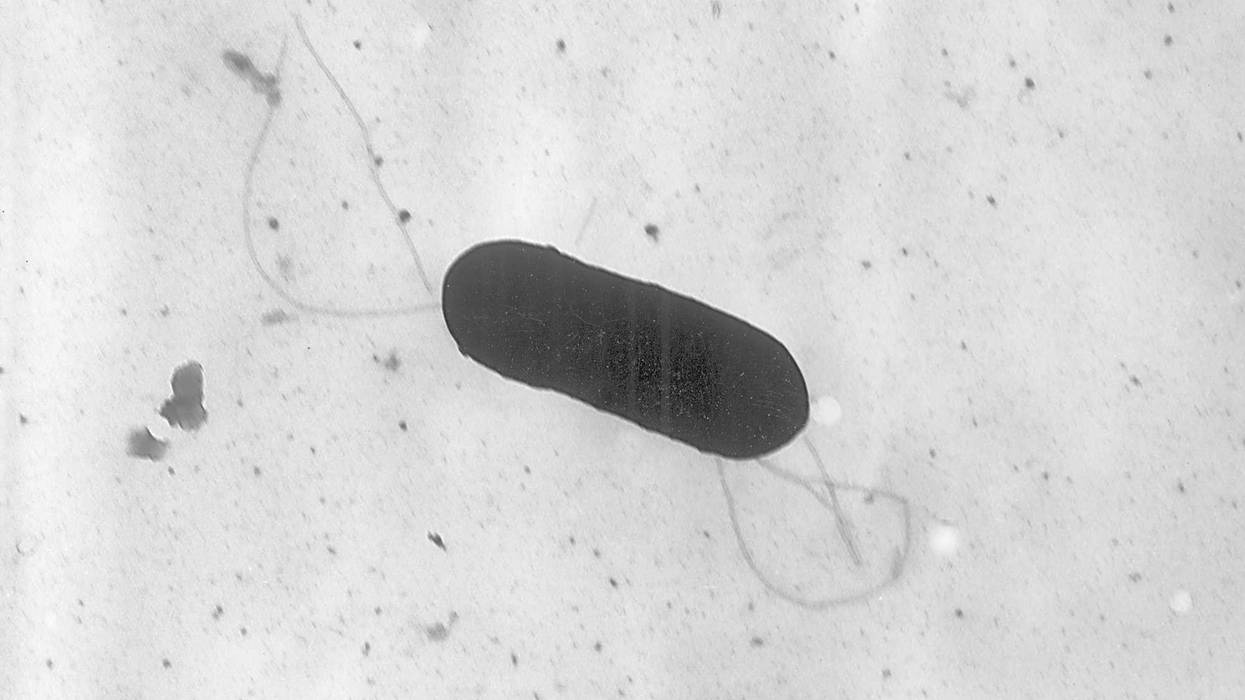 This 2002 electron microscope image made available by the Centers for Disease Control and Prevention shows a Listeria monocytogenes bacterium, responsible for the food borne illness listeriosis