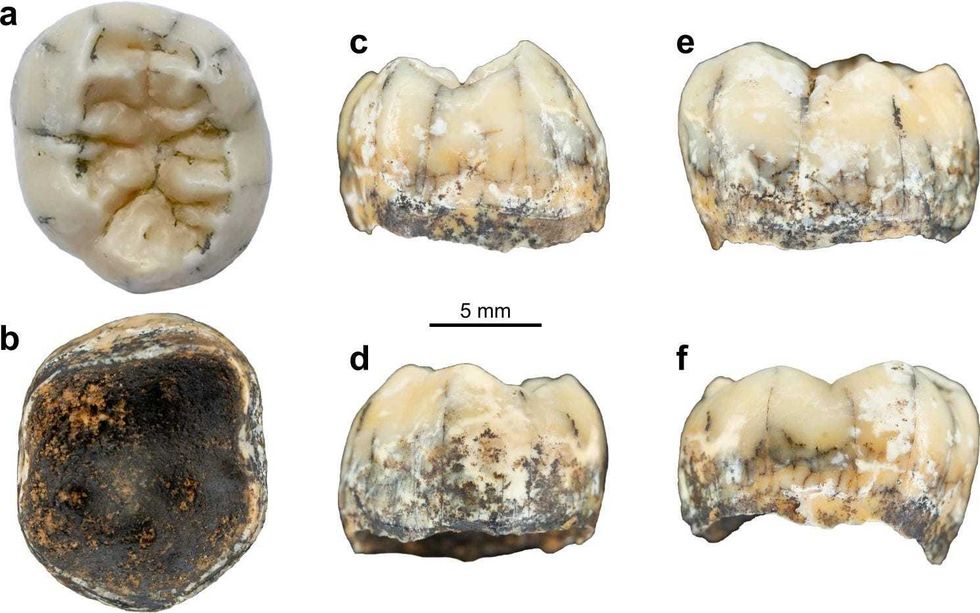 Tooth diagram