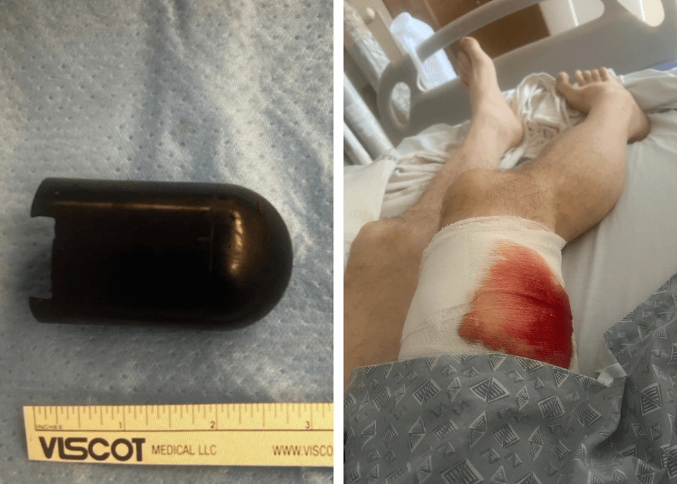 V. James DeSimone Law