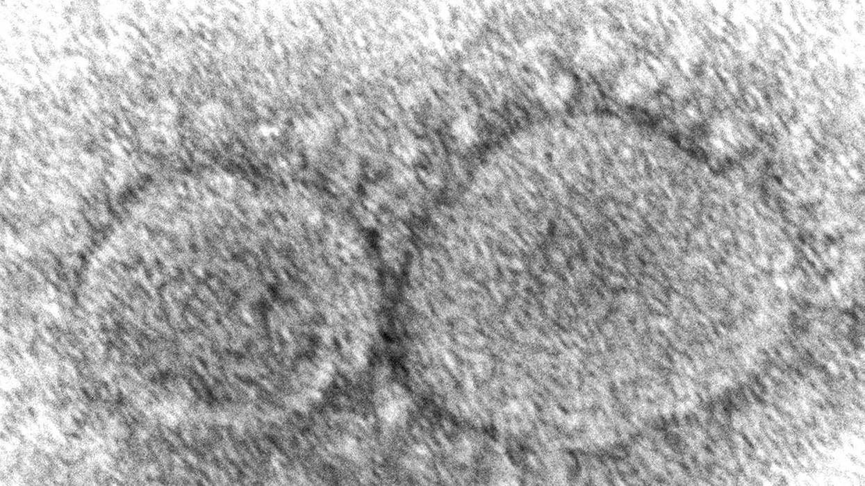 Virus Outbreak Tweaking Vaccines