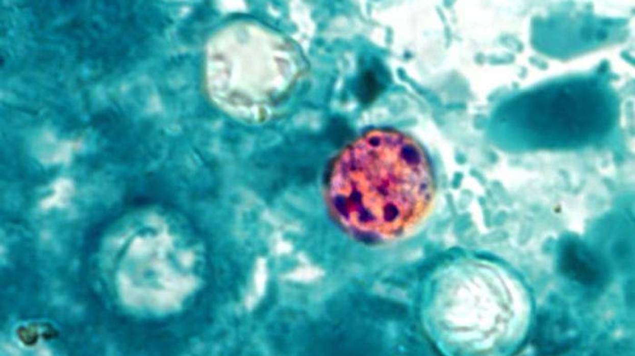 Michigan reports first 2 US deaths in outbreak of cyclospora