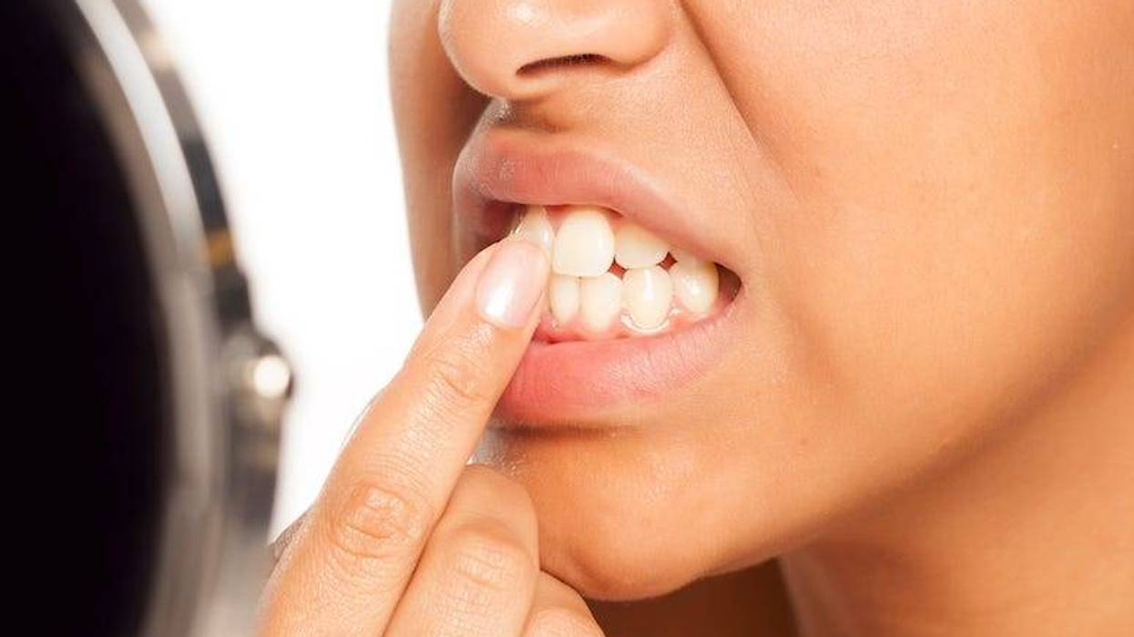Woman looking at teeth
