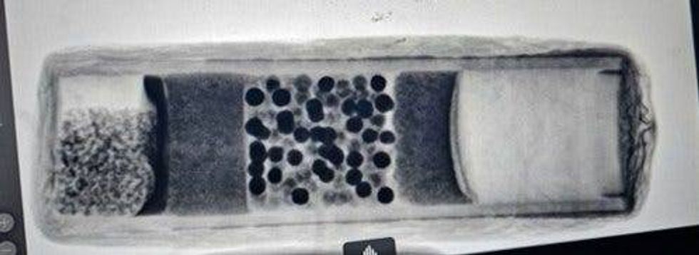 X-ray shows shrapnel inside a homemade bomb, according to police