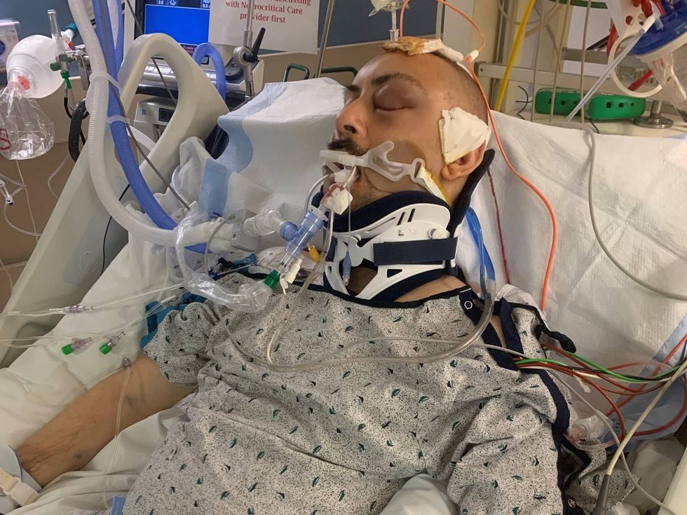 Zachary Lean, after being attacked by teens in Queen Village on Tuesday.